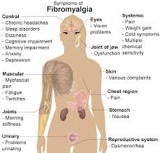 pain symptoms fibromyalgia